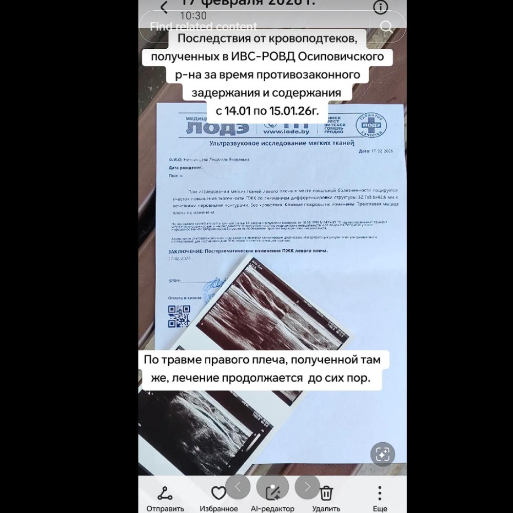 ренгтеновский снимок